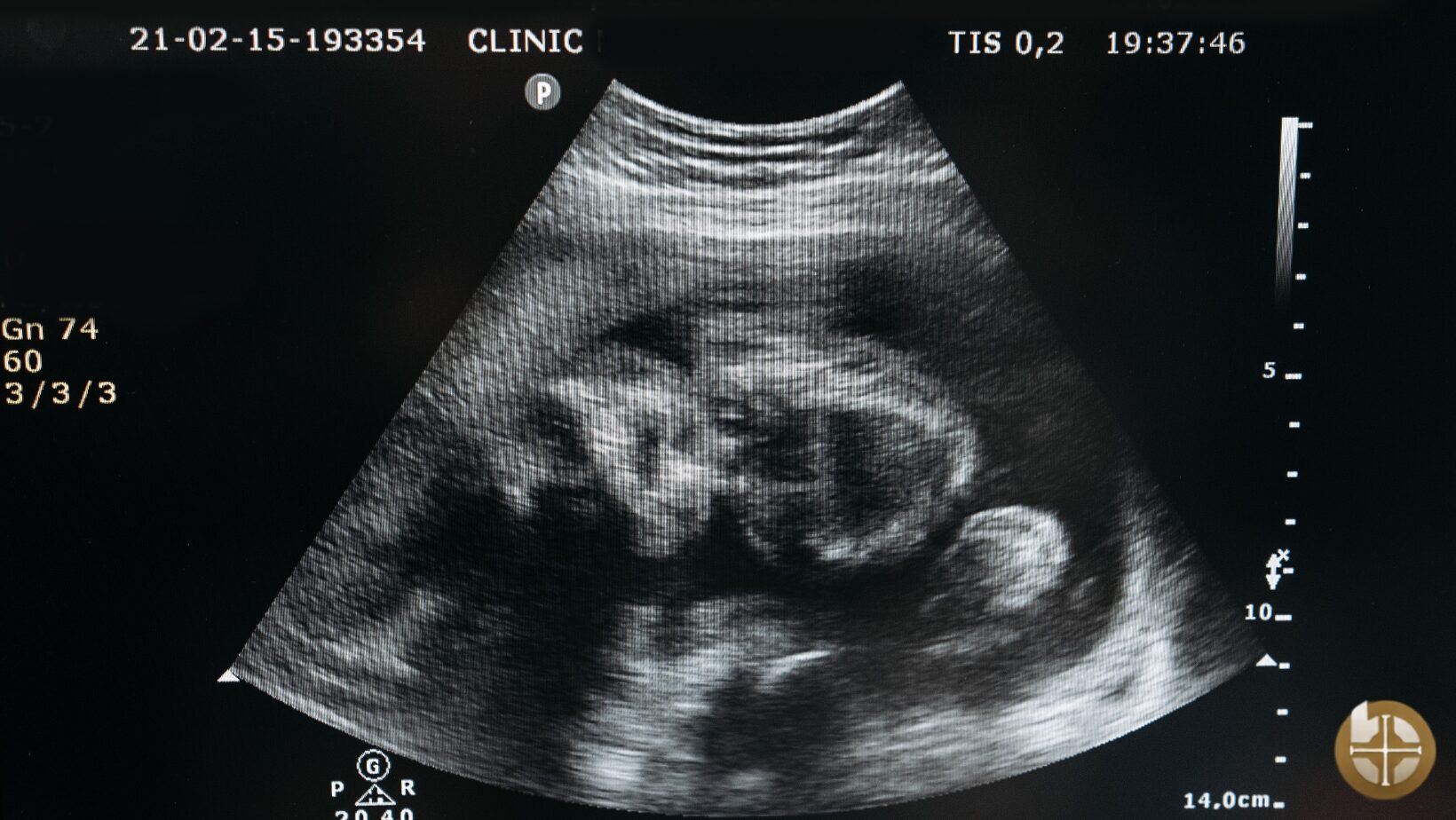 conception