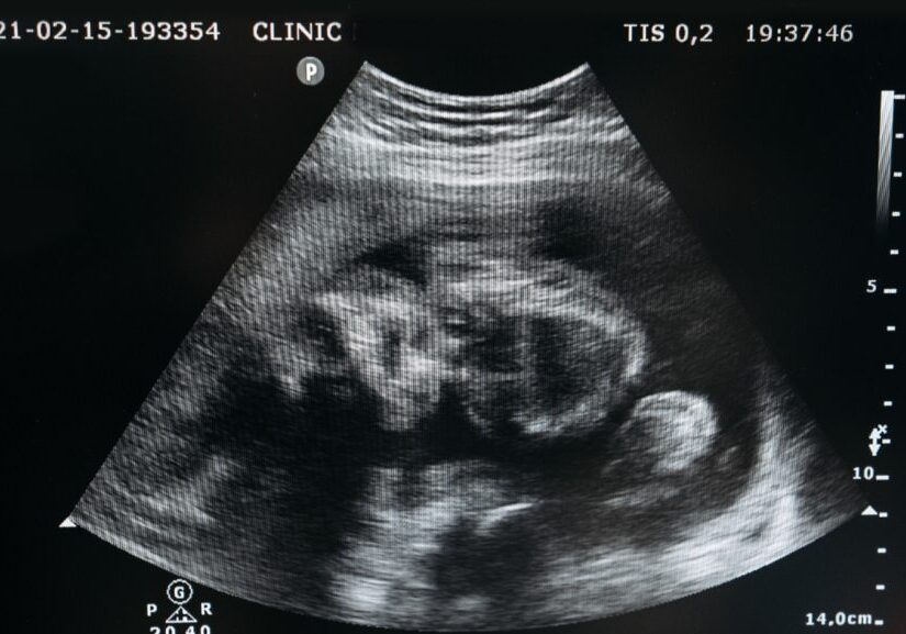 conception